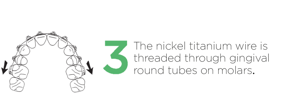 3.3