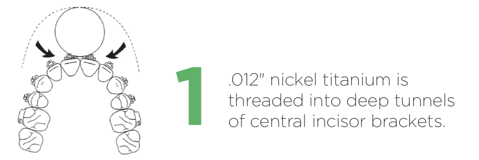 1.1